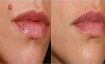 maxclinique.com